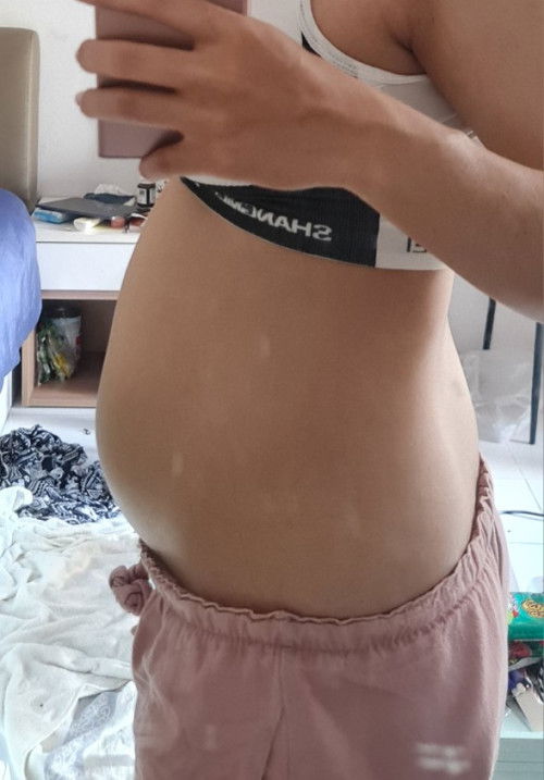 มีใครท้องขยายขนาดในระยะเวลาสั้นๆบ้างคะ 😅