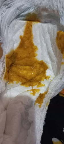 BAB bayi seperti ini apakah normal