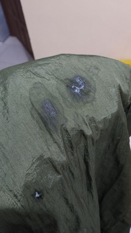 Bercak keputihan diusia 37 mgg