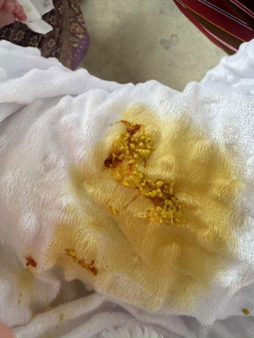 อึมีมูกอันตรายไหม