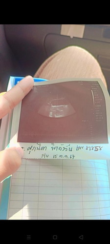 ไม่เจอตัวแต่ได้ยินเสียงหัวใจ