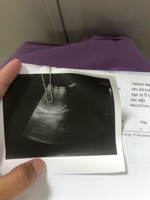 อยากถามแม่ๆว่าคุณหมอนัดไปตรวจครรภ์