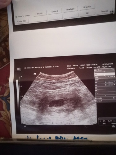 Dua kali scan masi nmpk kantung ja