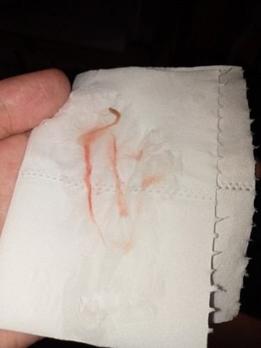 Bloody show