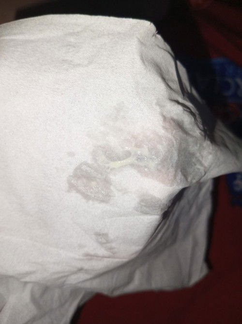 Bunda maaf mau tanya ini keputihan normal atau tanda2 mau melahirkan yaa ? Soalnya saya kurang paham