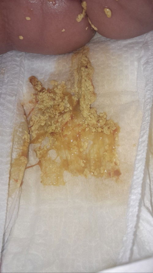 Najis baby 2 bulan 20 hari