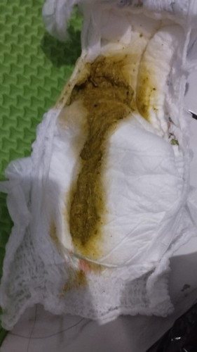 Selamat malam bund, mau nanya anak saya pup 4 kali dalam sehari apakah normal bun, pup nya kaya gitu