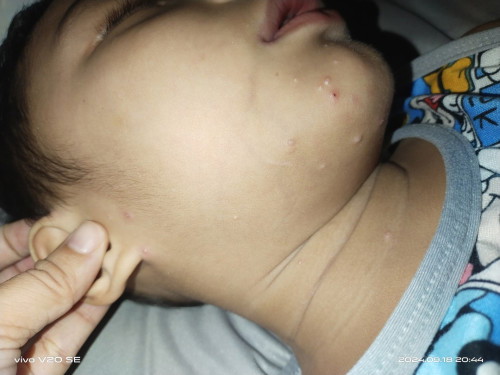Mga Mii ano kaya tong tumubo sa katawan ng anak ko?