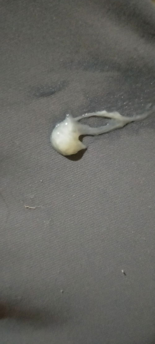 Sticky discharge w/o blood