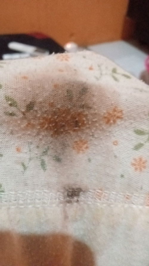 bund tlog bantu ada pengalaman ya saye ngeflek hamil 9 minggu pdahal sebelumnya gak pernah