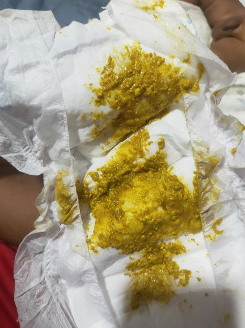 สอบถามแม่ๆหน่อยคะ เมื่อวานน้องกินนมผงกับนมแม่ไป แบบนี้น้อง อึ ปกติ หรือไม่คะ