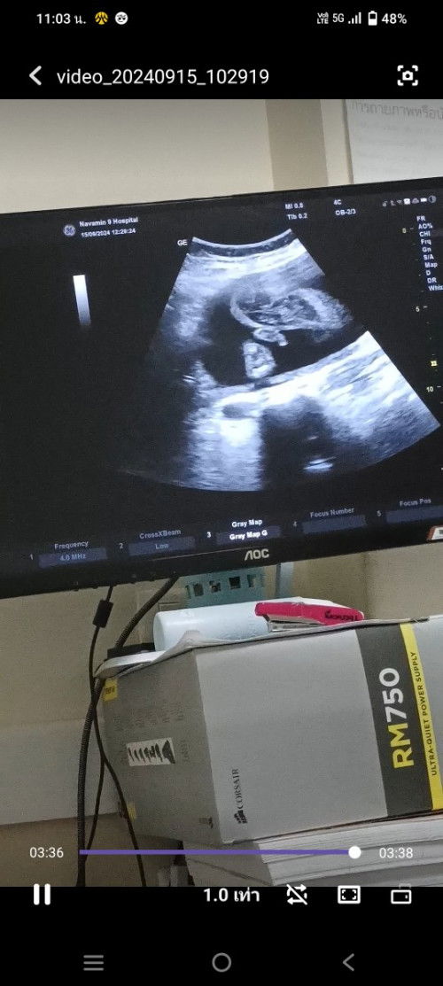 อยากรู้เพศทีมมกราคม