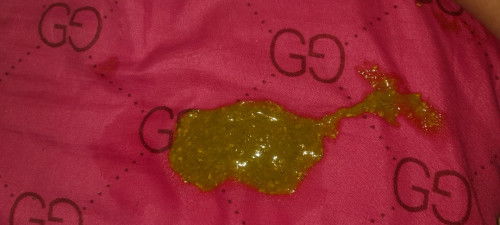 อึวัย4เดือน