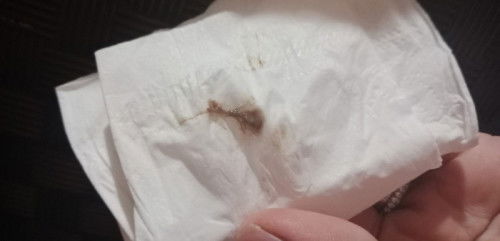 Implantation bleeding or not?