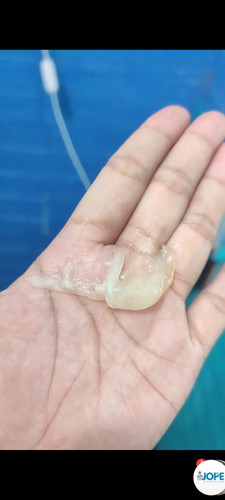 Pasintabi po ...
38 weeks po may lumabas na ganto sakin... Ano po kaya to ?
