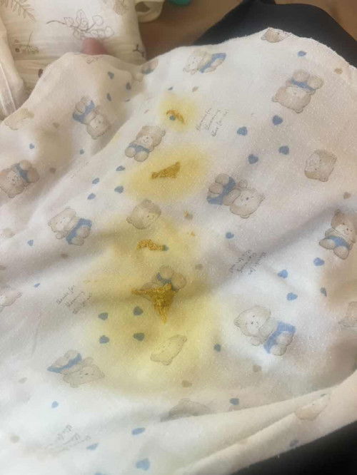 อึแบบนี้ ถือว่าแพ้นมชงไหม