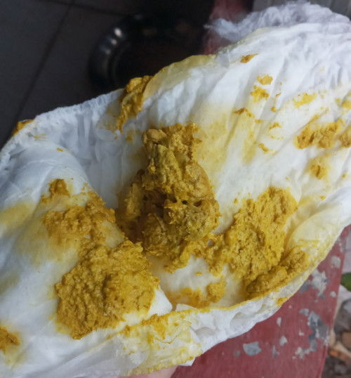 Tanya feses bayi 4 bulan, baru pertama kali coba sufor