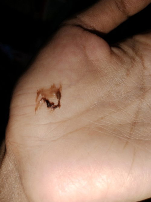 Flek di usia 4week6hari