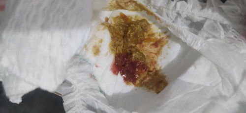 Blood on Baby's Poop
