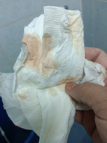 มีน้ำออกมาแบบนี้ และมีอาการปวดๆท้องน้อย บางทีก็เหมือนจะปวดอึ อาการแบบนี้ใกล้คลอดยังค่ะ ขอคำแนะนำค่ะ