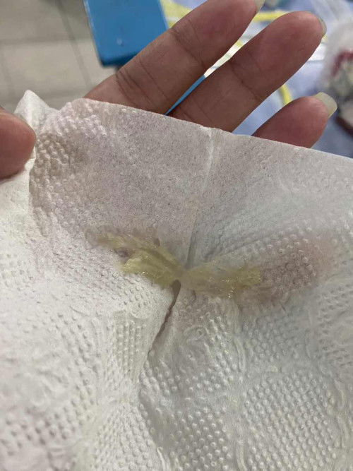 แบบนี้ต้องไปหาหมอเลยมั้ยคะ