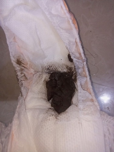 anung ibig sabihin sa Itim na kulay ng tae ni baby?