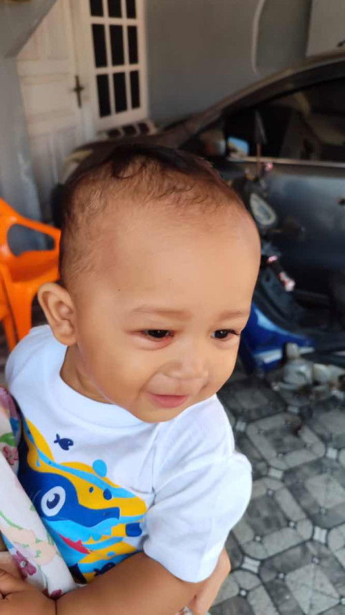 bintik putih d mata,