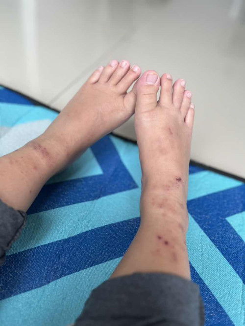 Kulit kaki sering gatal2