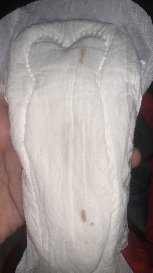 Hasil Usg 7w5h klo hpht 10week , dan masih kantung janin . gmn ya bun ?