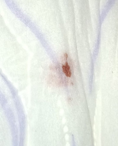 Kalau mcm ni tanda penempelan ke period?