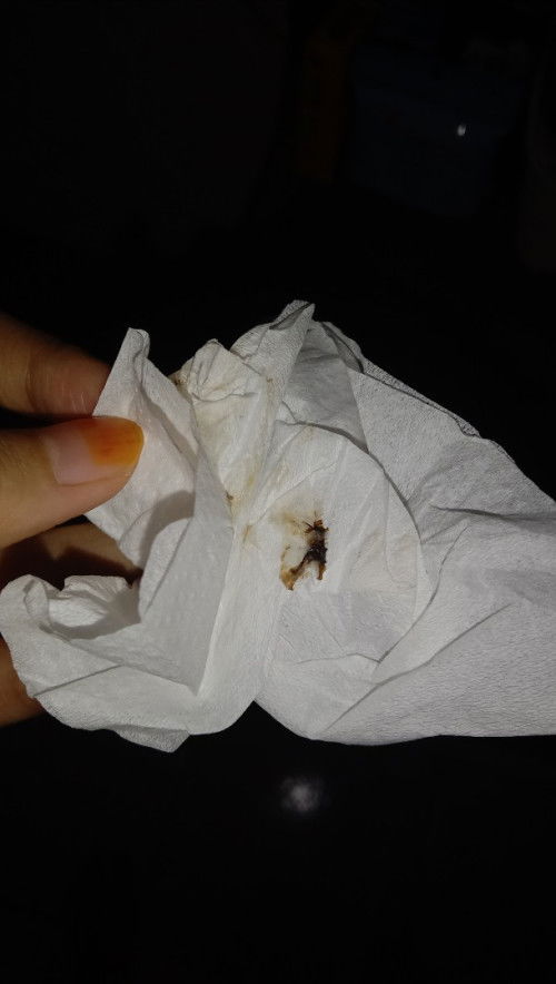 Keputihan dan flek selama hamil