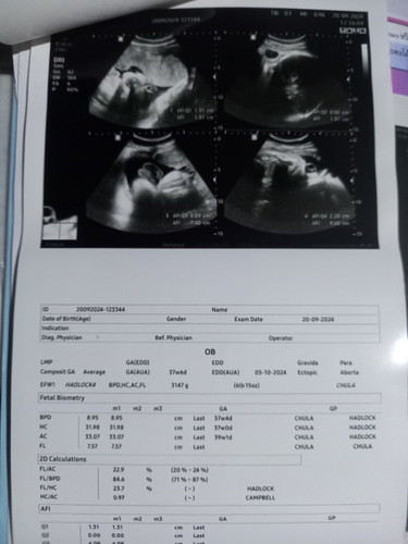 39w+2d ไปหาคุณหมอมาได้กระตุ้นปากมดลูก ส่วนตัวเจ็บเหมือนกันค่ะ เดินไม่ออกเลย หมอบอกว่าคลอดแน่ๆ