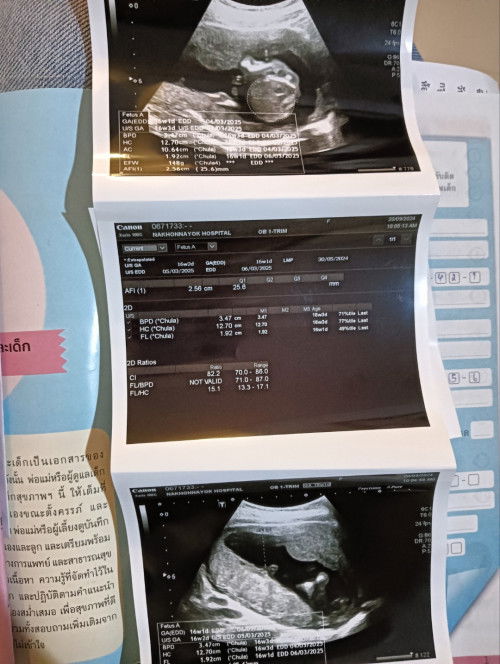 สอบถามเรื่องนี้หน่อยค่ะ