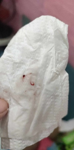 Mucus plug