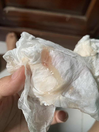 Usia kehamilan 37 minggu