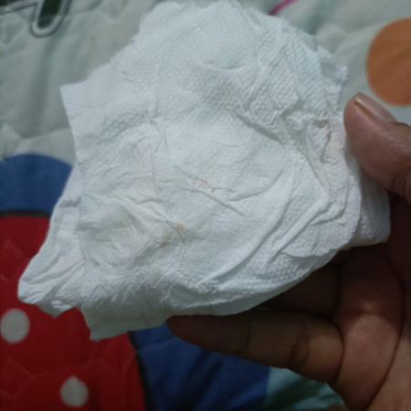 มีเลือดออกนิดเดียว
