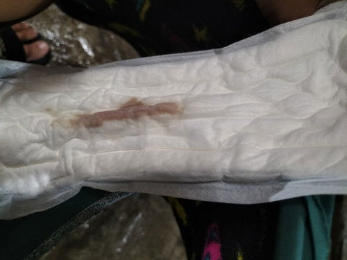 Bleeding @7months preggy