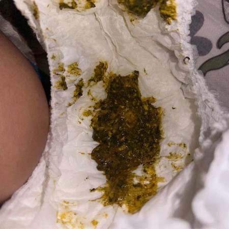 ขอโทษ สำหรับรูปภาพนะคะ🙏