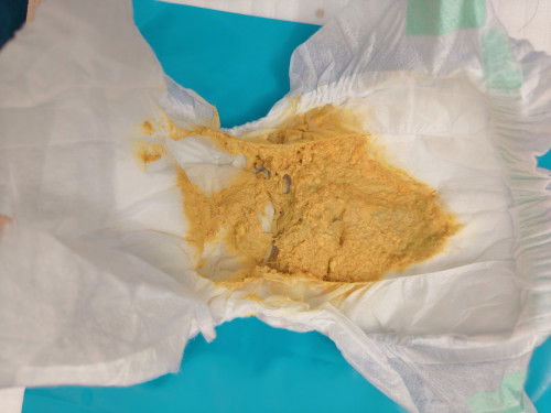 น้องอึเป็นเม็ดแบบนี้ปกติมั้ยคะ น้องอายุ  26 วัน