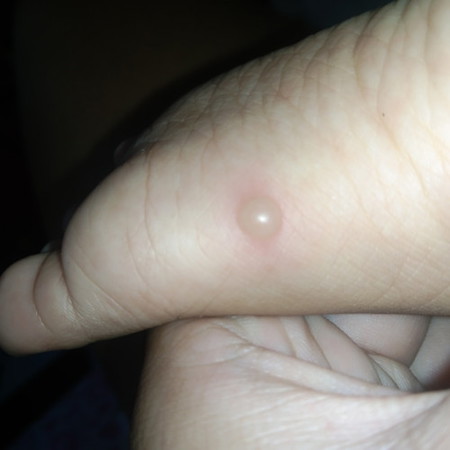 Ano po kaya itong tumubo sa paa nang baby ko..🥺