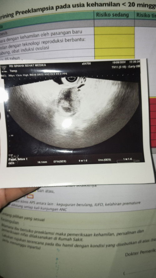 Risau krena belum ada janin