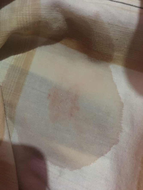 Keluar air campur darah