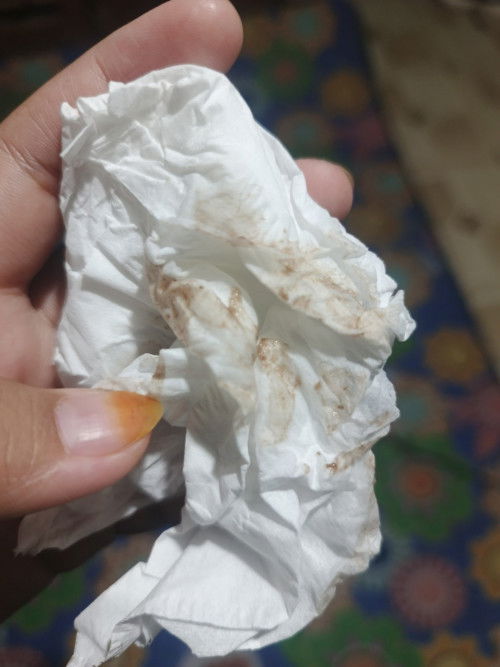 Tiba tiba aku ngeflek kek gini bun, bahaya ngak ya 😭