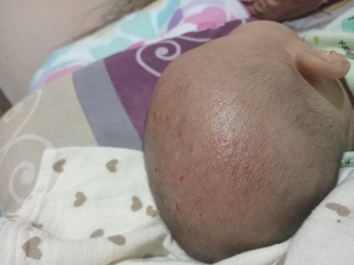 gatal bintik merah dibagian kepala