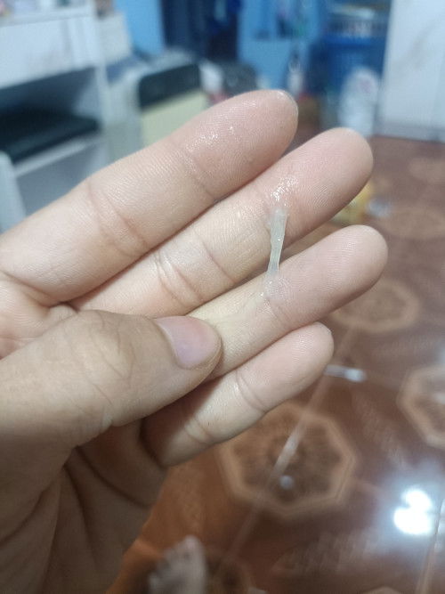 แบบนี้ตกขาวหรือมูกใสค่ะ#38+2วีคค่ะ