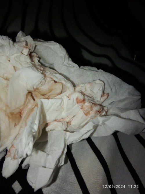 Keluar darah warna pink bercampur keputihan apakah aman yah Bun