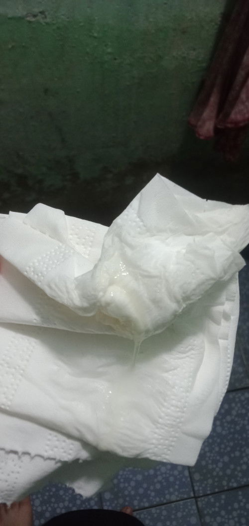 Cho em hỏi cái này là bung nút nhầy đúng không ạ