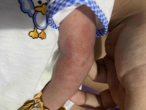 Disebabkan karna apa ?