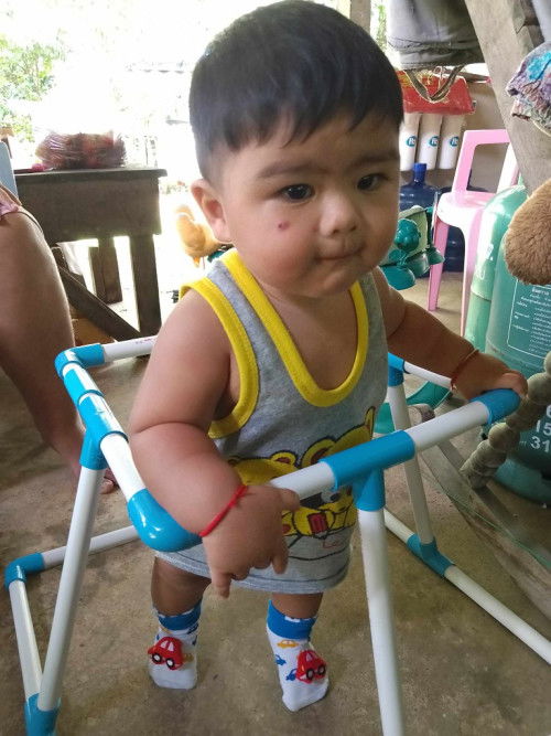 แผลเป็นที่หน้าจากยุง