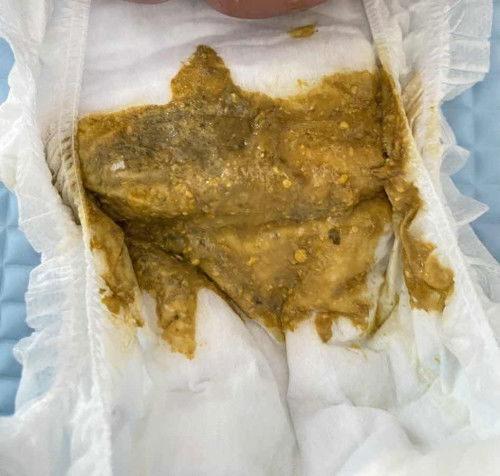 normal ke tak? bantu saya